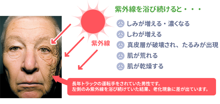 ブリリアントスキンプログラム