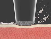 【STEP１】角質除去