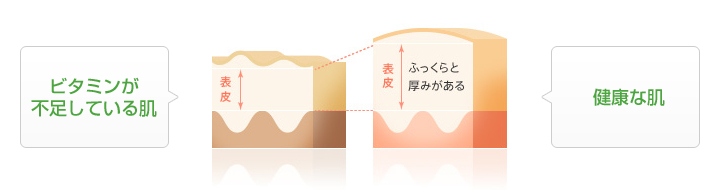 ビタミンが不足している肌と健康な肌