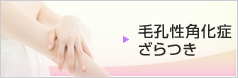 毛孔性角化症・ざらつき